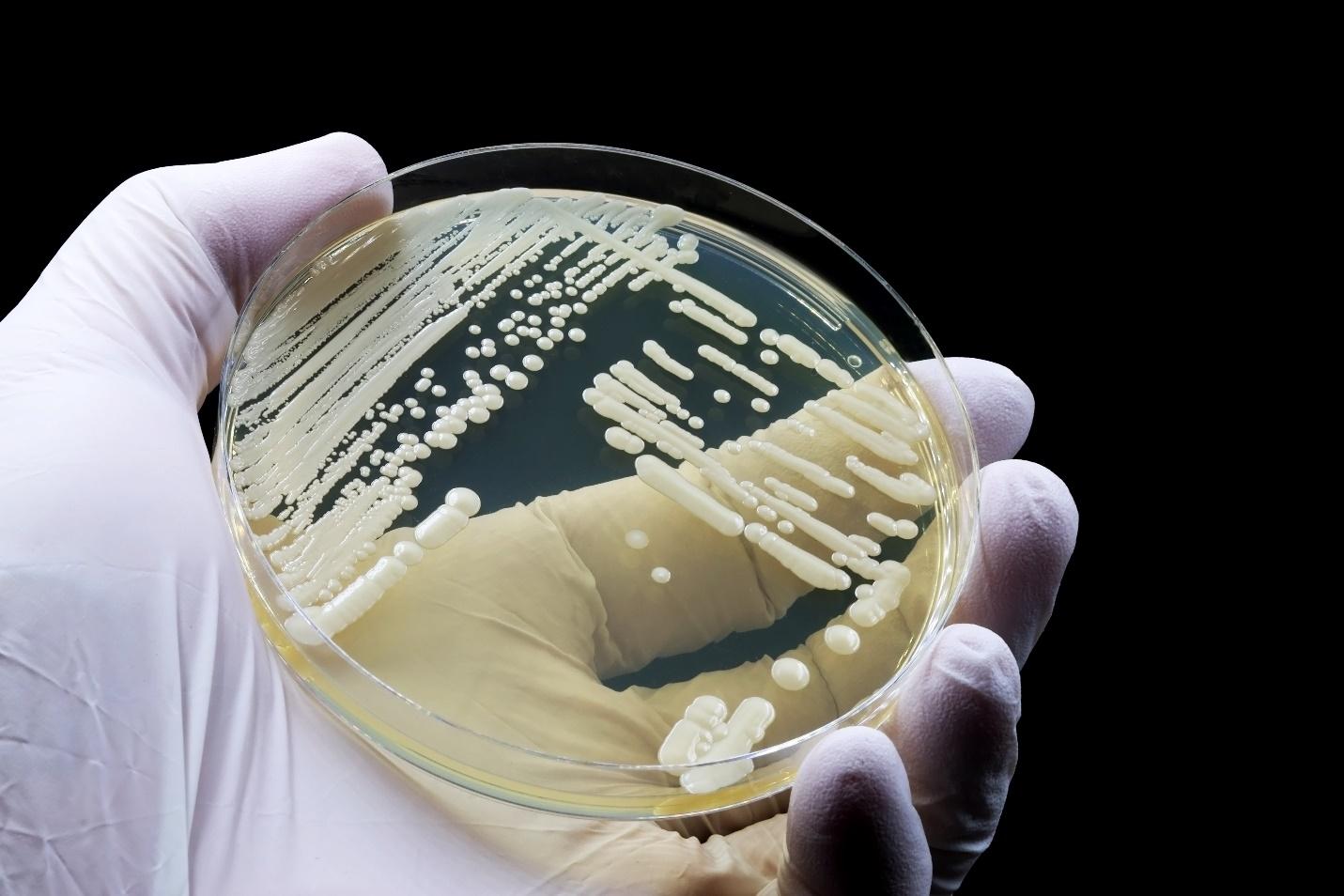 A hand holding a petri dish

AI-generated content may be incorrect.