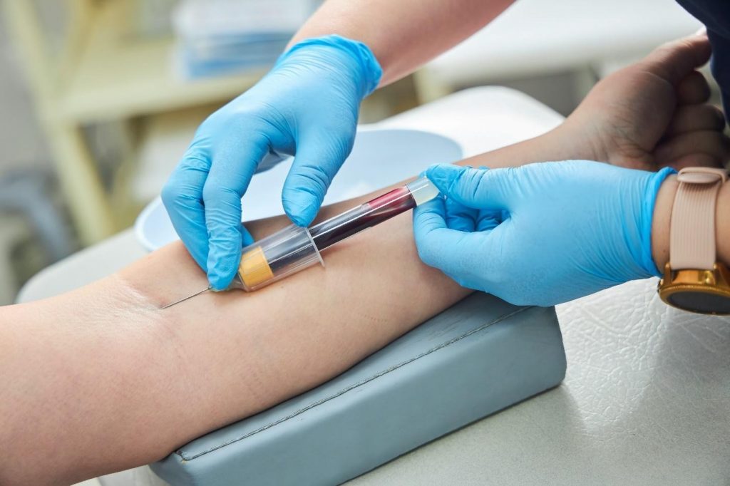 purpose of blood test.