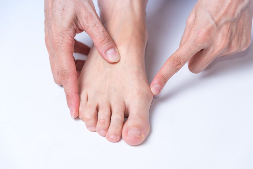 bunion flat feet high arch foot assessment Singapore.