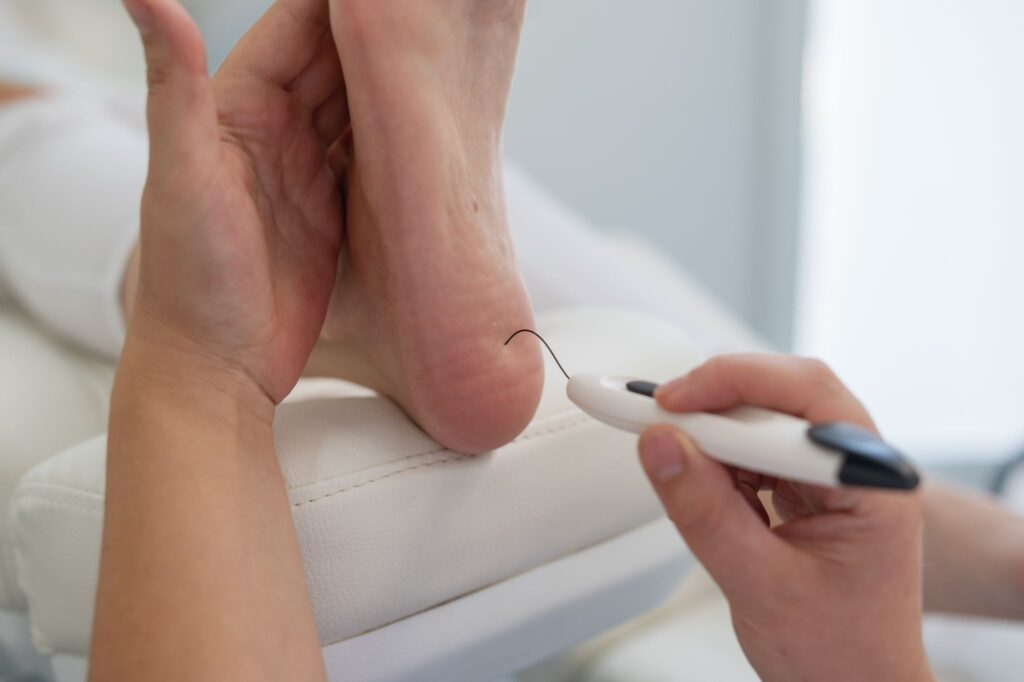 diabetic foot care podiatry assessment Singapore.