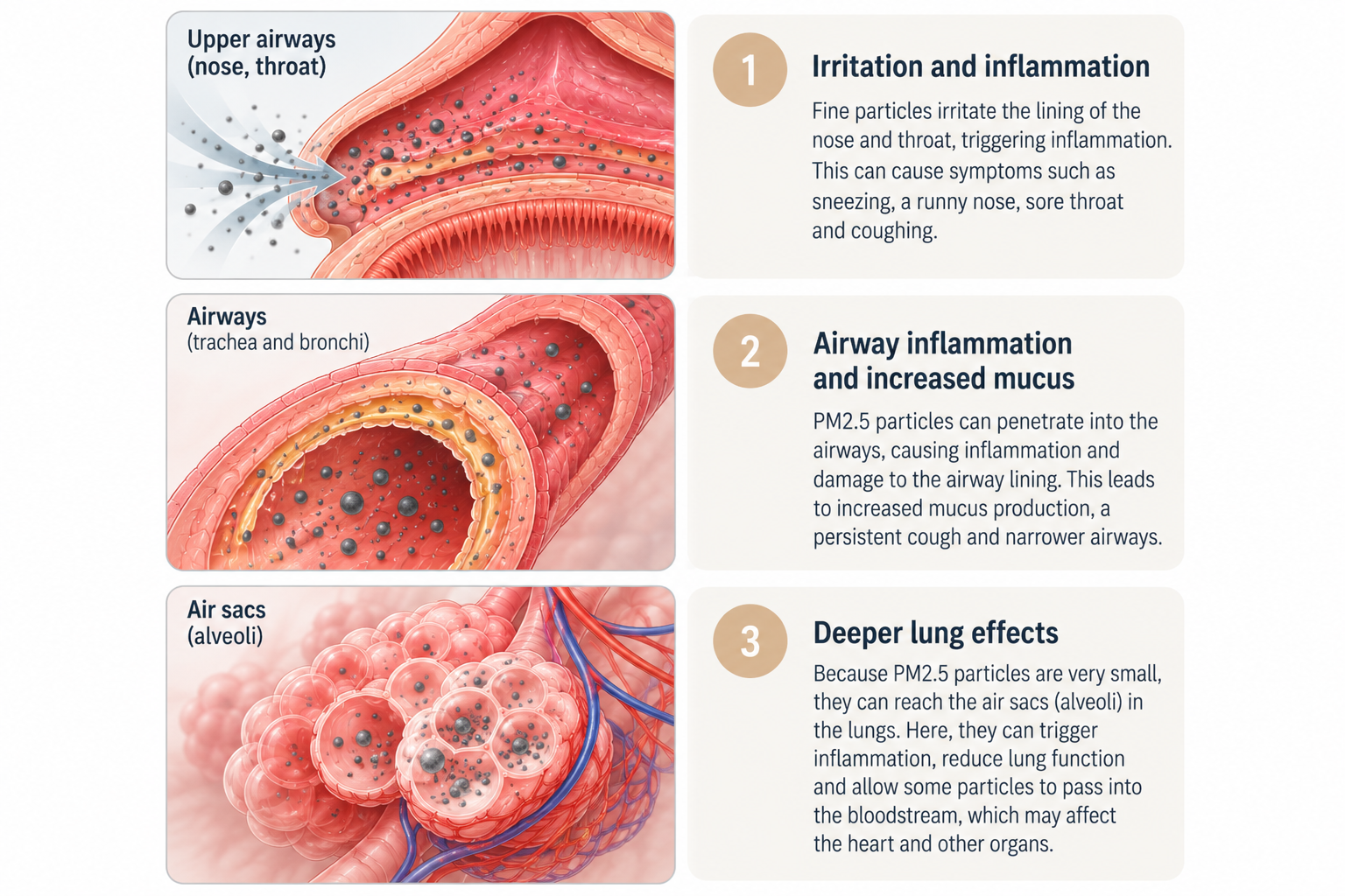 Medical illustration showing how PM2.5 particles from haze enter the respiratory system, irritate the nose and throat, inflame the airways and penetrate deep into the lungs.